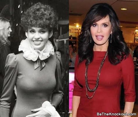 marie osmond boobs|Marie Osmond: Before and After